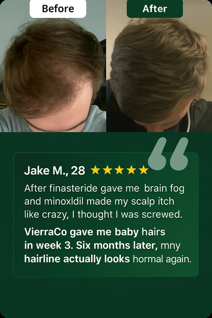 Root Revival Follicle Activator